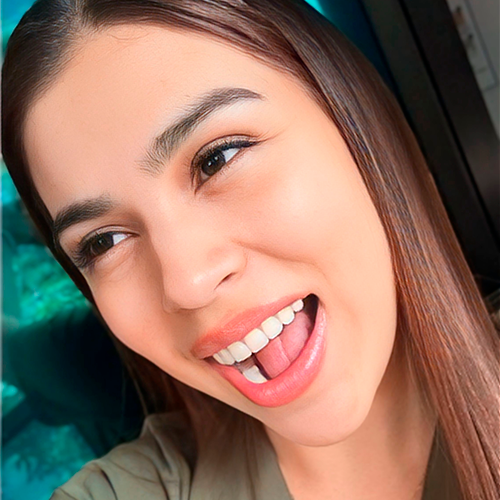 Imagen de Blanqueamiento dental